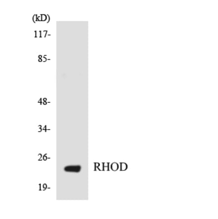Western Blot - Anti-RHOD Antibody (R12-3439) - Antibodies.com