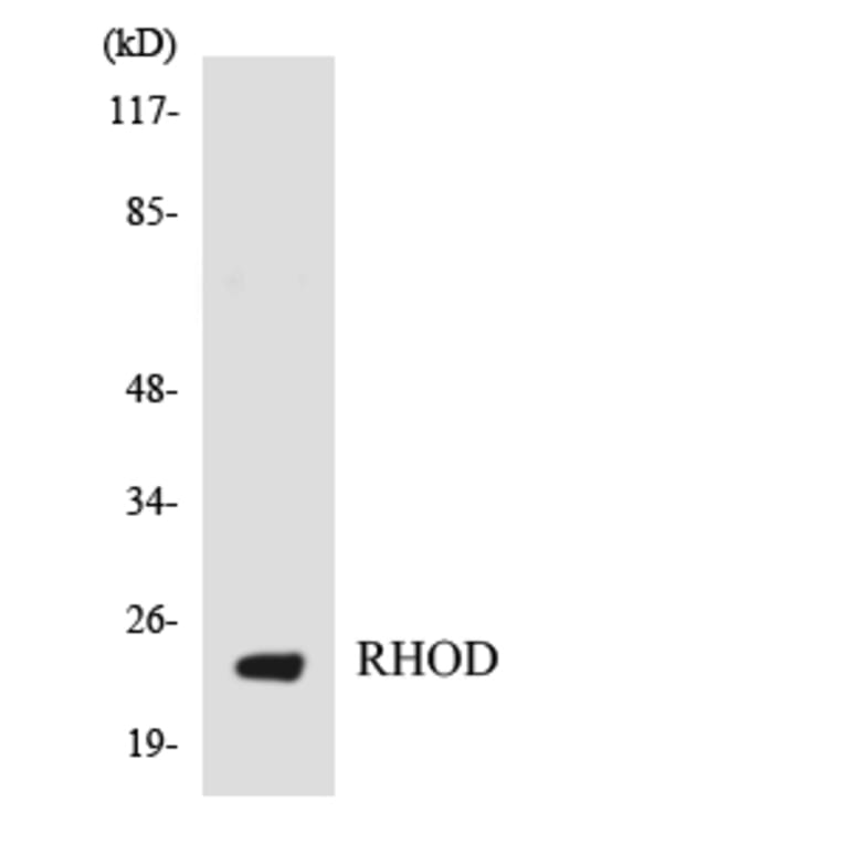 Western Blot - Anti-RHOD Antibody (R12-3439) - Antibodies.com