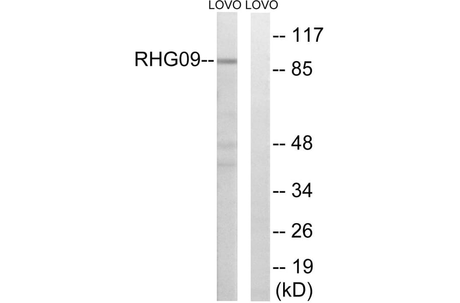 Western Blot - Anti-RHG9 Antibody (C18383) - Antibodies.com