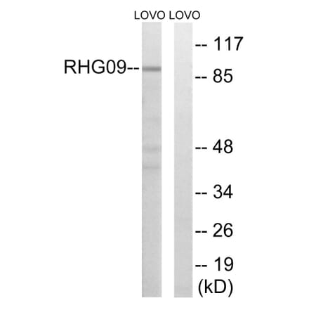 Western Blot - Anti-RHG9 Antibody (C18383) - Antibodies.com