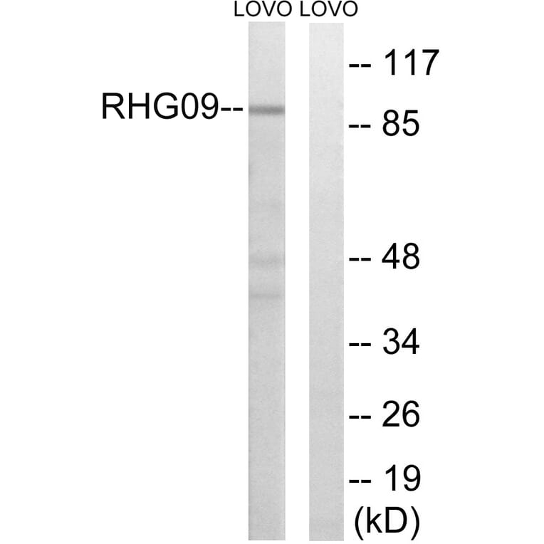 Western Blot - Anti-RHG9 Antibody (C18383) - Antibodies.com