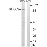 Western Blot - Anti-RHG9 Antibody (C18383) - Antibodies.com