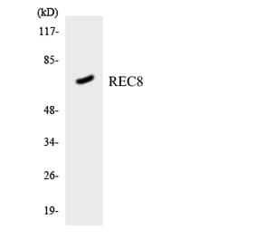 Western Blot - Anti-REC8 Antibody (R12-3416) - Antibodies.com
