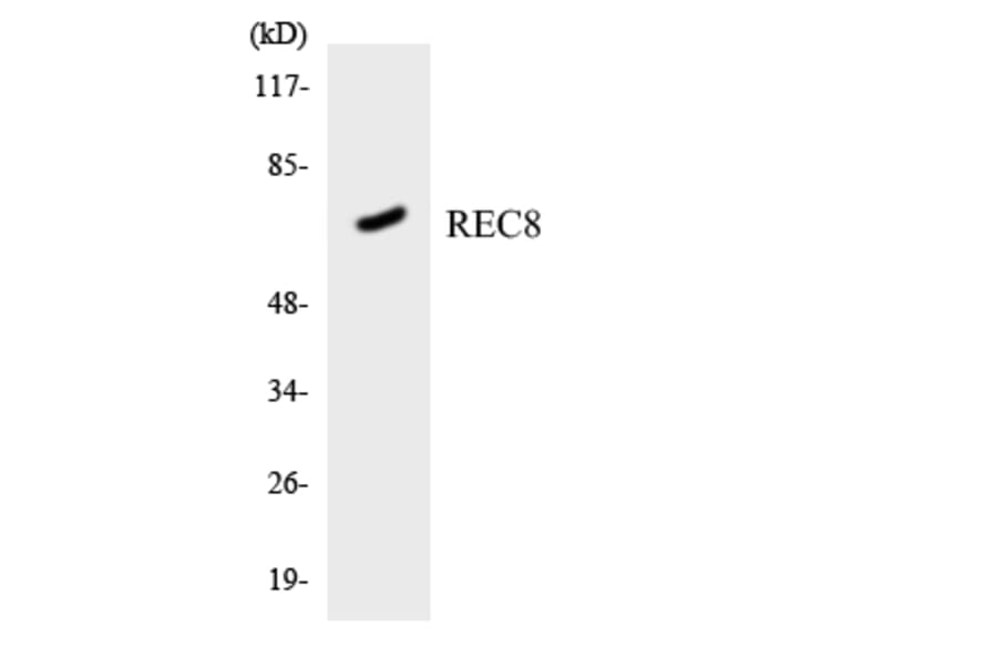 Western Blot - Anti-REC8 Antibody (R12-3416) - Antibodies.com