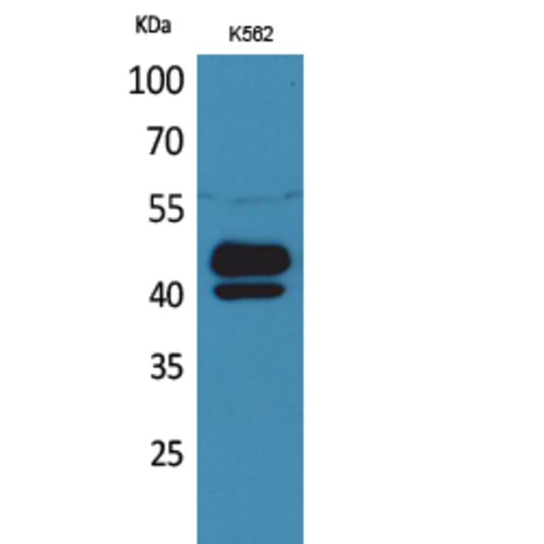 Western Blot - Anti-PSG1 Antibody (C30378) - Antibodies.com