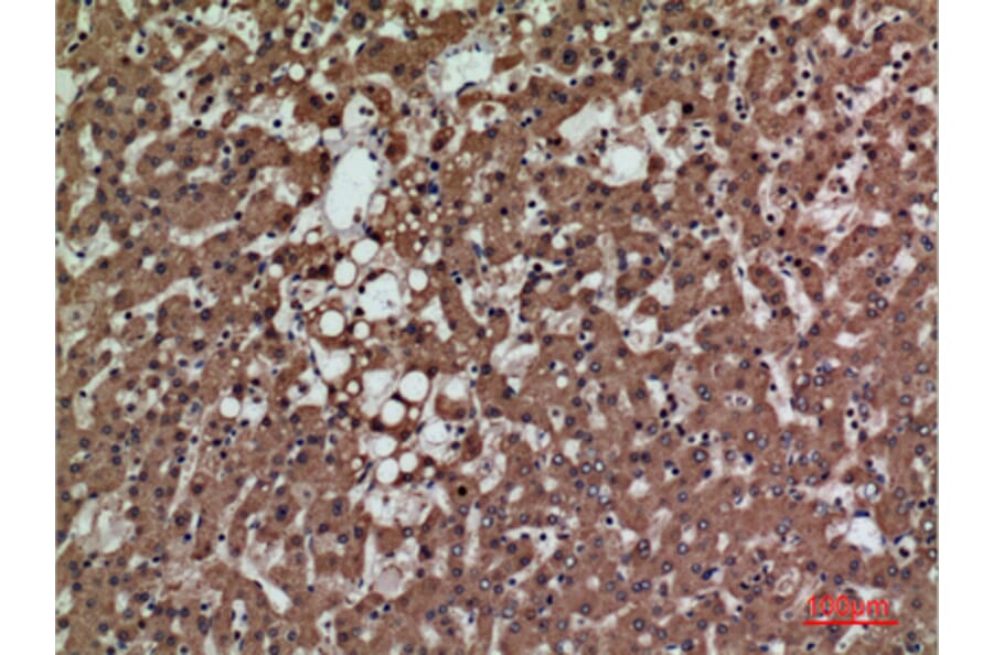 Immunohistochemistry - Anti-PSG1 Antibody (C30378) - Antibodies.com