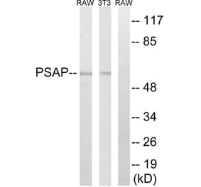 Western Blot - Anti-PSAP Antibody (C17862) - Antibodies.com