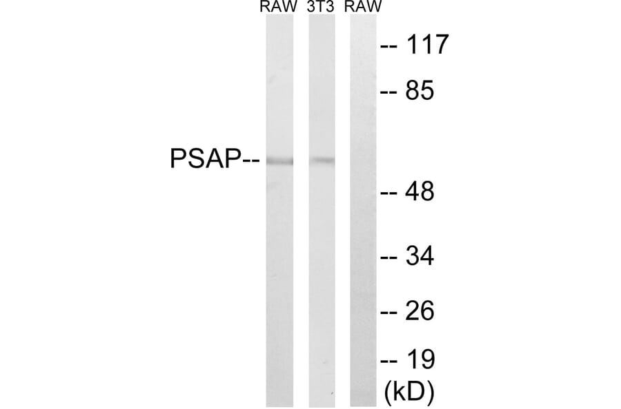Western Blot - Anti-PSAP Antibody (C17862) - Antibodies.com