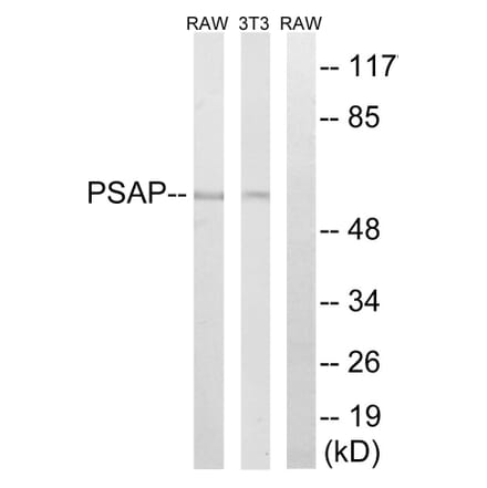 Western Blot - Anti-PSAP Antibody (C17862) - Antibodies.com