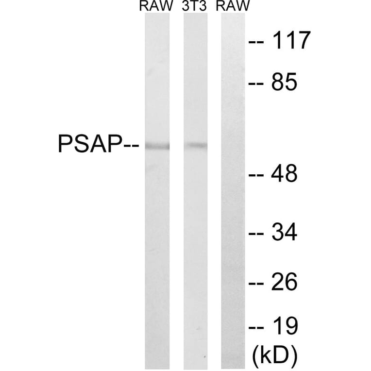 Western Blot - Anti-PSAP Antibody (C17862) - Antibodies.com