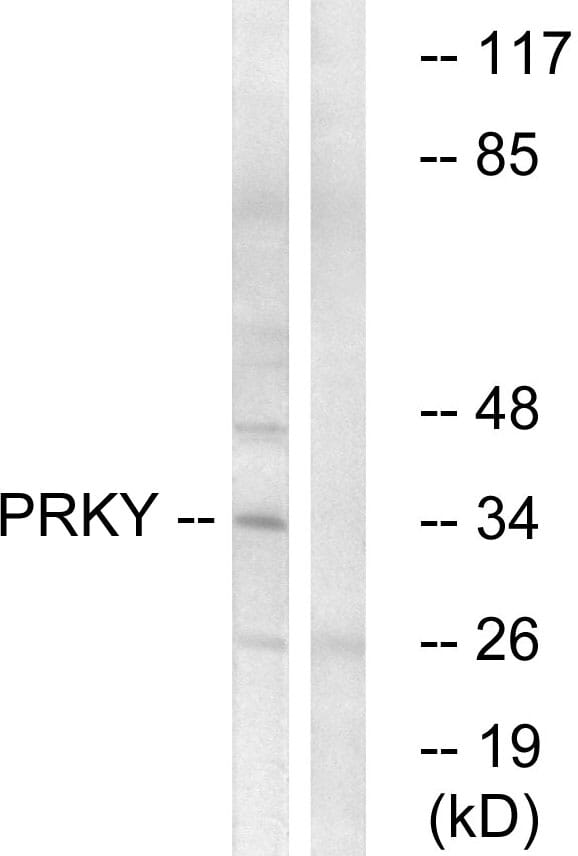 Western blot analysis of lysates from Jurkat cells using Anti-PRKY Antibody. The right hand lane represents a negative control, where the antibody is blocked by the immunising peptide.