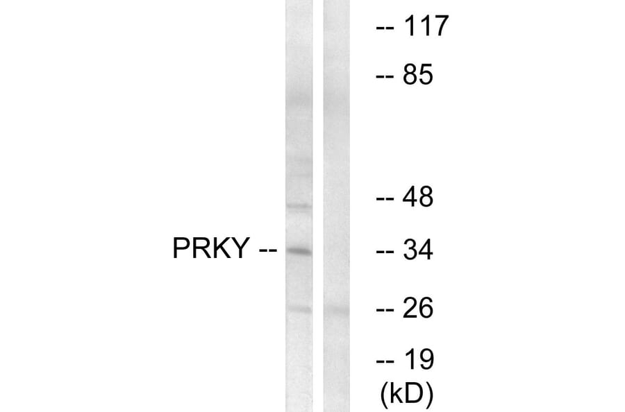 Western Blot - Anti-PRKY Antibody (C18602) - Antibodies.com
