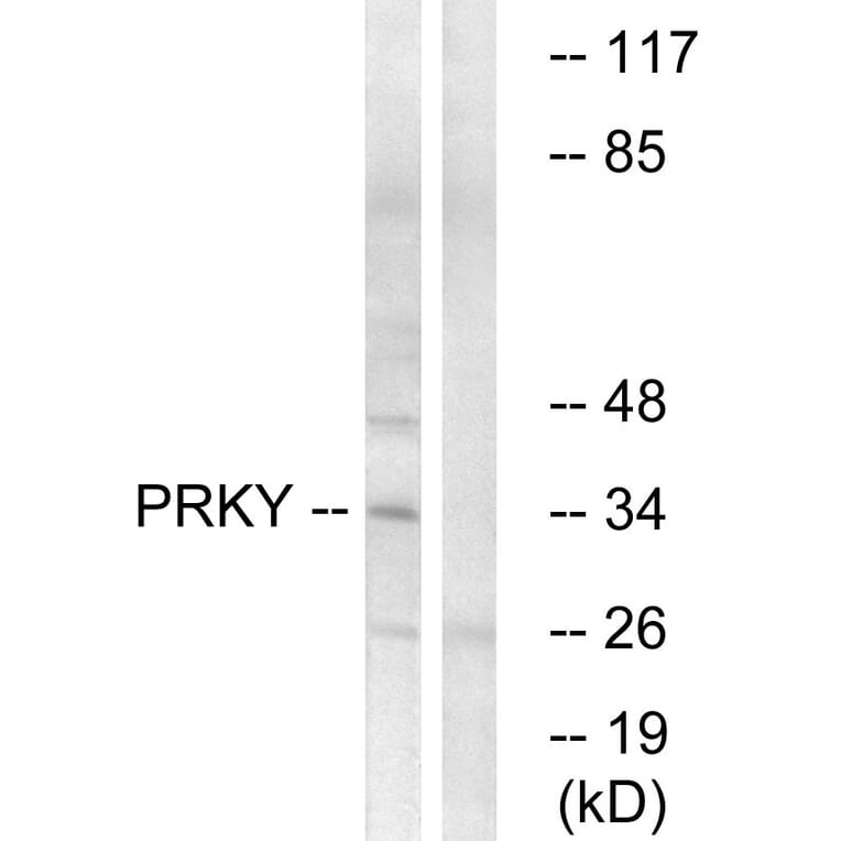 Western Blot - Anti-PRKY Antibody (C18602) - Antibodies.com