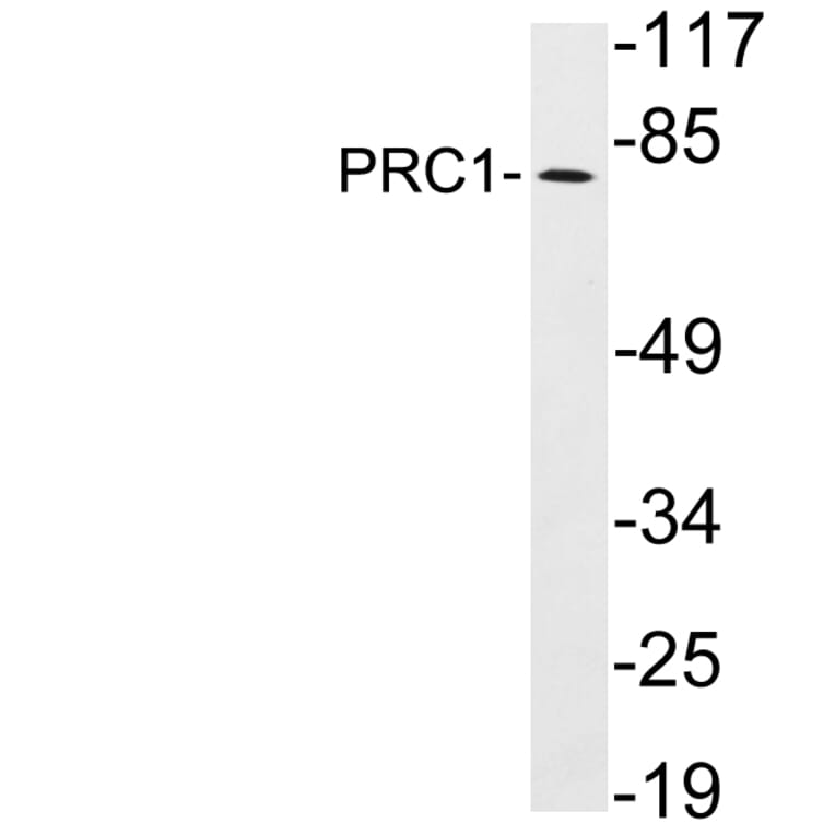 Western Blot - Anti-PRC1 Antibody (R12-2319) - Antibodies.com