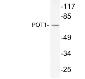 Western Blot - Anti-POT1 Antibody (R12-2315) - Antibodies.com