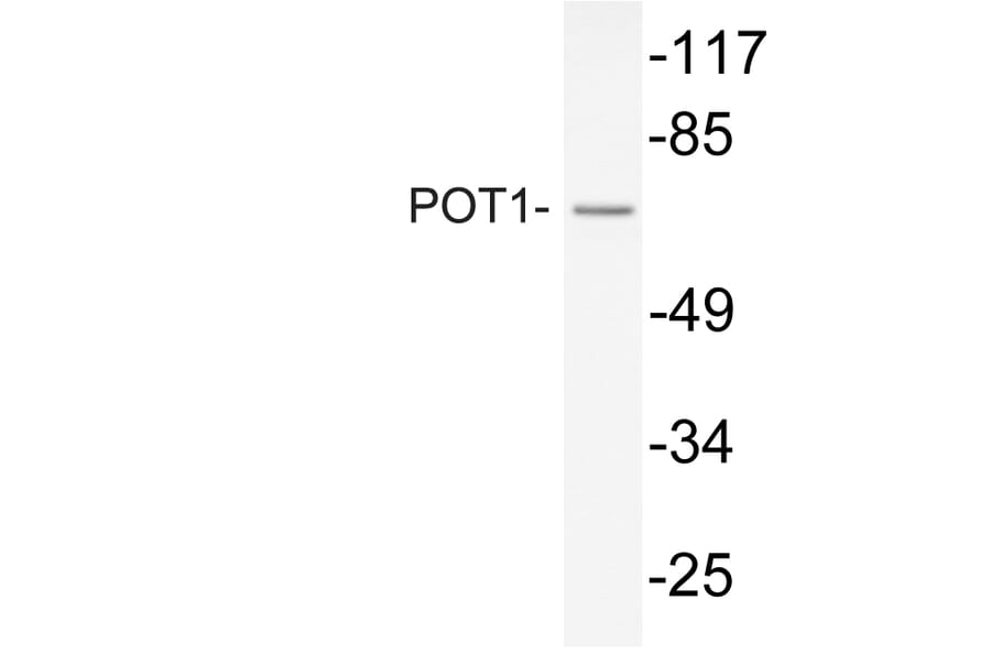 Western Blot - Anti-POT1 Antibody (R12-2315) - Antibodies.com