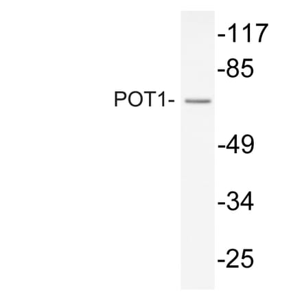 Western Blot - Anti-POT1 Antibody (R12-2315) - Antibodies.com