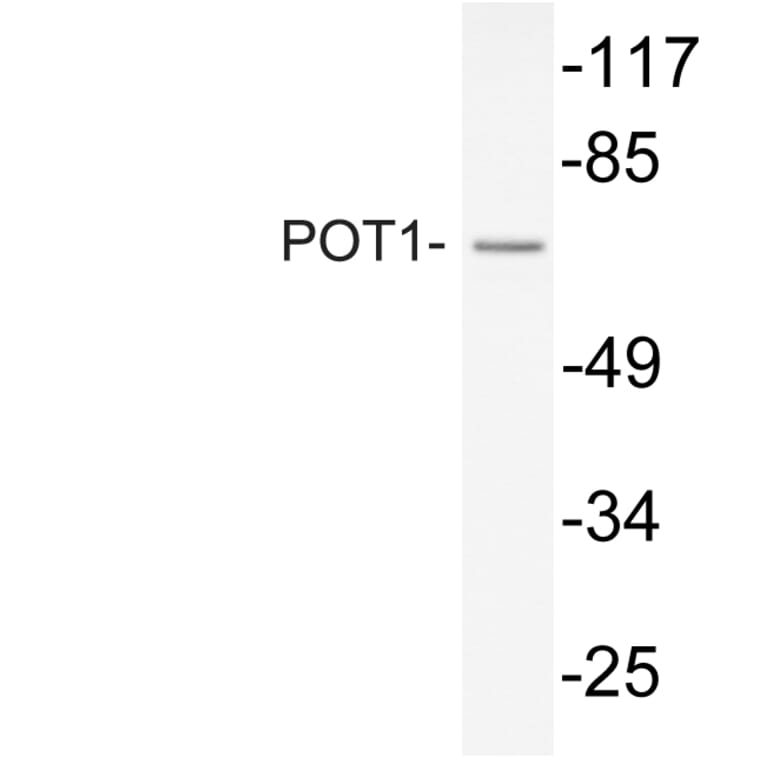 Western Blot - Anti-POT1 Antibody (R12-2315) - Antibodies.com