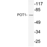 Western Blot - Anti-POT1 Antibody (R12-2315) - Antibodies.com