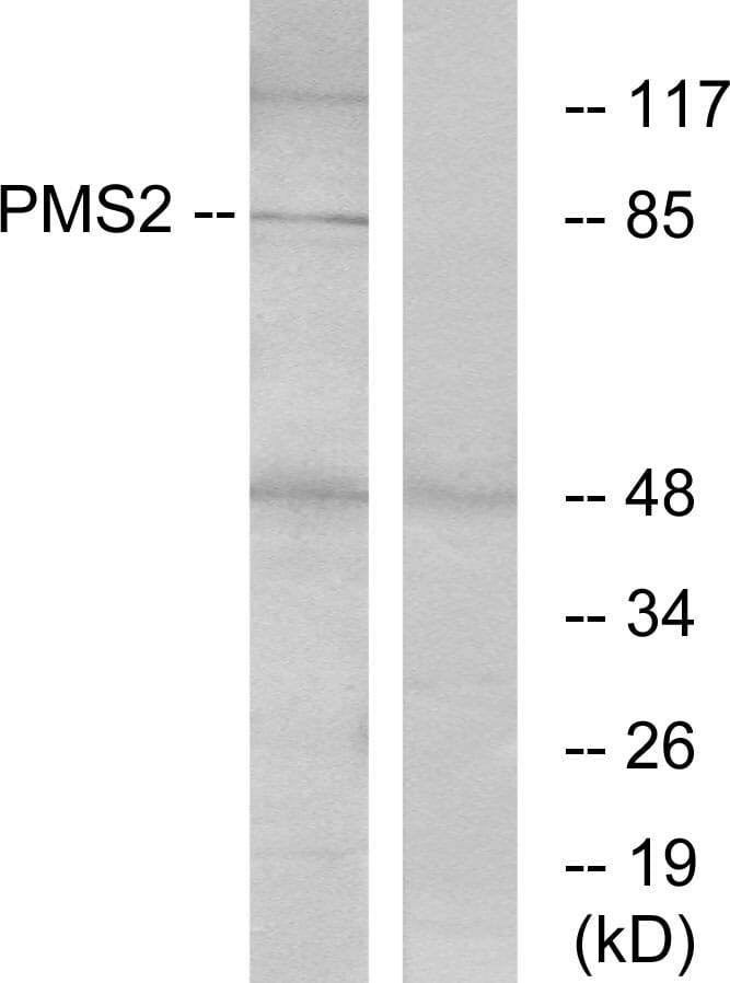 Western blot analysis of lysates from HeLa cells using Anti-PMS2 Antibody. The right hand lane represents a negative control, where the antibody is blocked by the immunising peptide.