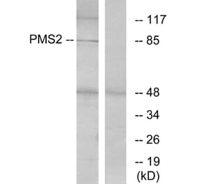 Western Blot - Anti-PMS2 Antibody (C13104) - Antibodies.com