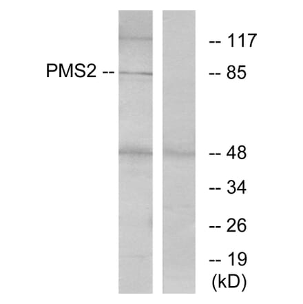 Western Blot - Anti-PMS2 Antibody (C13104) - Antibodies.com