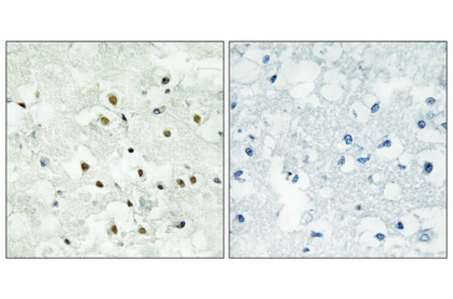 Immunohistochemistry - Anti-PMS2 Antibody (C13104) - Antibodies.com