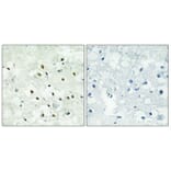 Immunohistochemistry - Anti-PMS2 Antibody (C13104) - Antibodies.com