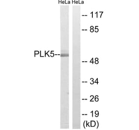 Western Blot - Anti-PLK5 Antibody (C18600) - Antibodies.com