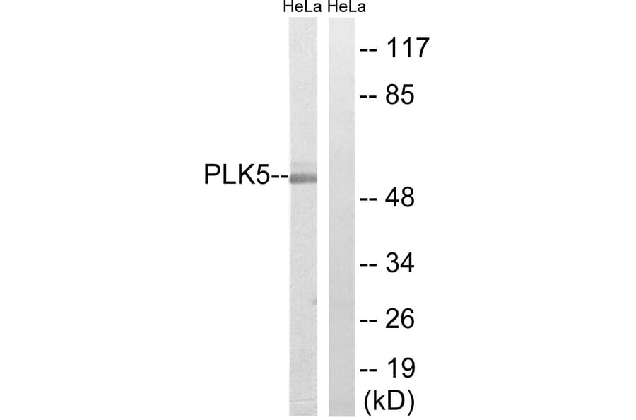 Western Blot - Anti-PLK5 Antibody (C18600) - Antibodies.com