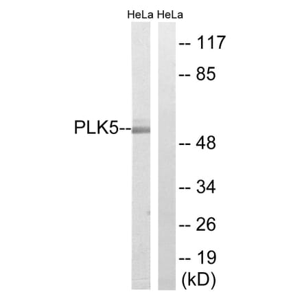 Western Blot - Anti-PLK5 Antibody (C18600) - Antibodies.com