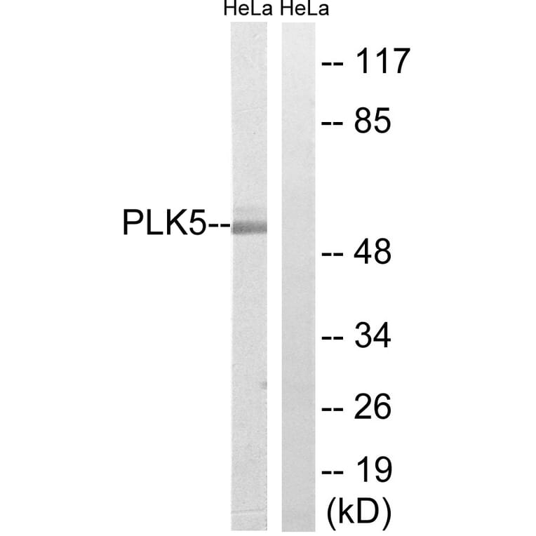 Western Blot - Anti-PLK5 Antibody (C18600) - Antibodies.com