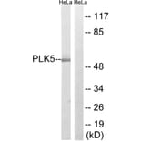 Western Blot - Anti-PLK5 Antibody (C18600) - Antibodies.com