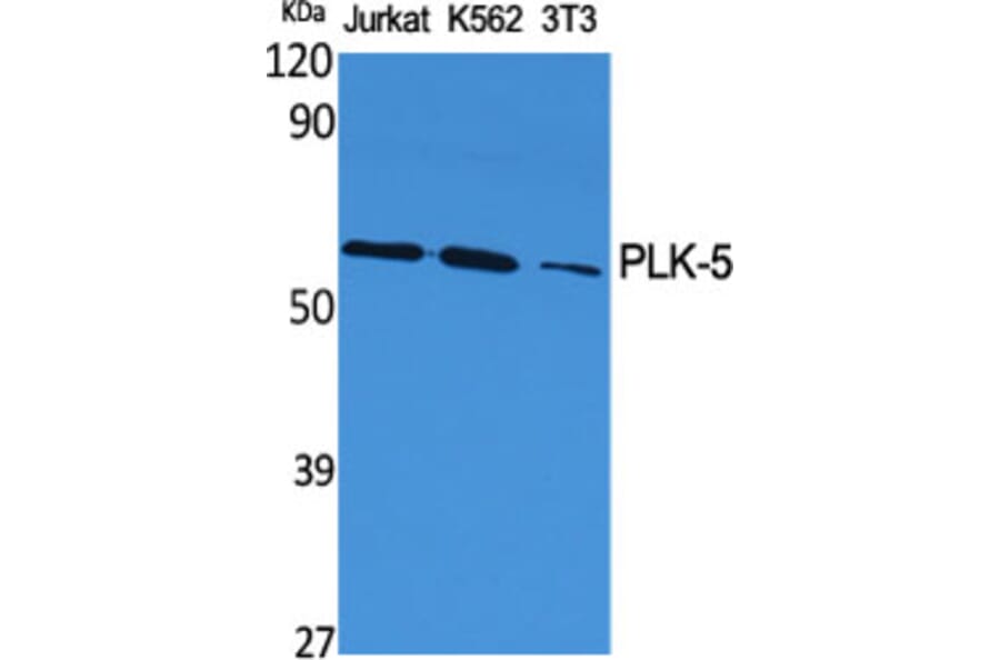 Western Blot - Anti-PLK5 Antibody (C18600) - Antibodies.com