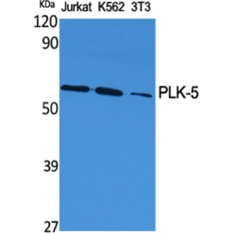 Western Blot - Anti-PLK5 Antibody (C18600) - Antibodies.com