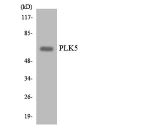 Western Blot - Anti-PLK5 Antibody (R12-3339) - Antibodies.com