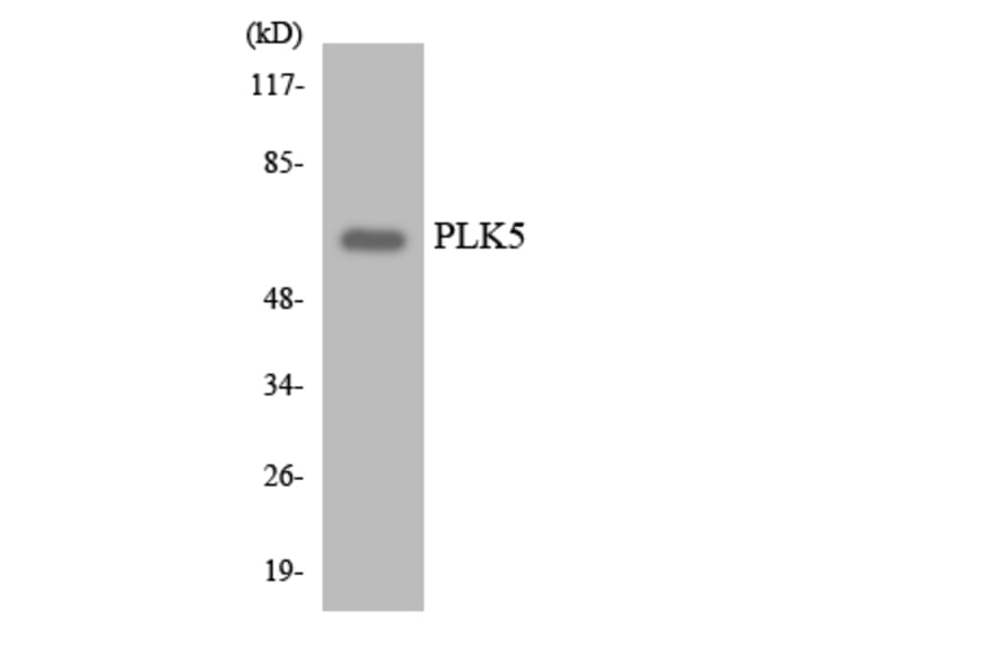Western Blot - Anti-PLK5 Antibody (R12-3339) - Antibodies.com