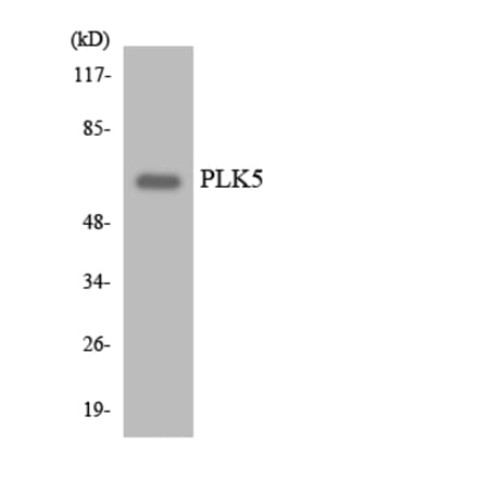 Western Blot - Anti-PLK5 Antibody (R12-3339) - Antibodies.com