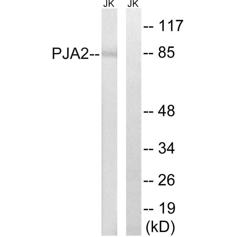 Western Blot - Anti-PJA2 Antibody (C15563) - Antibodies.com