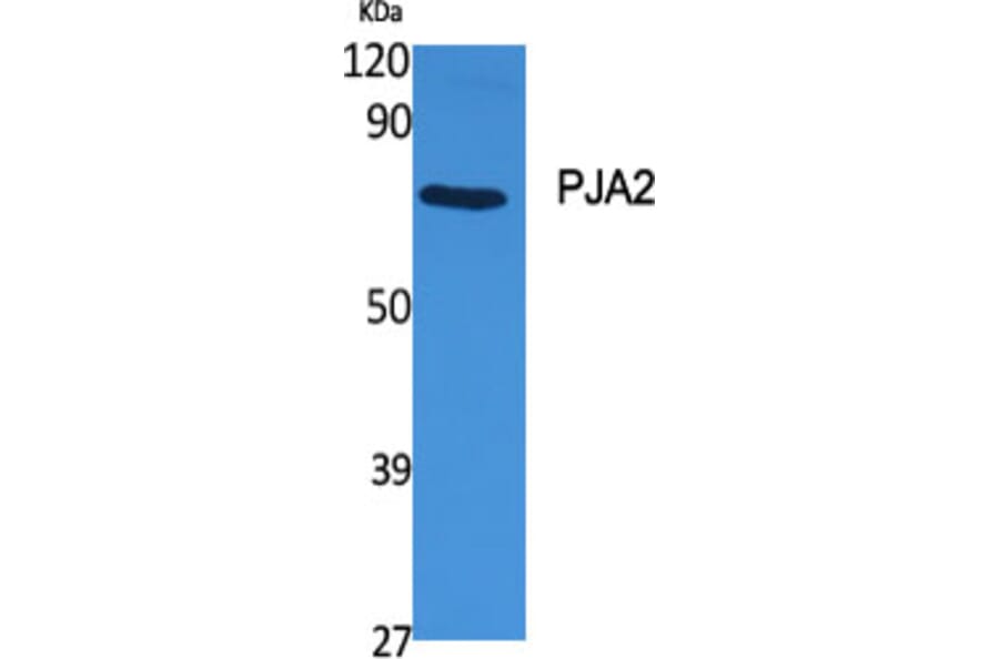 Western Blot - Anti-PJA2 Antibody (C15563) - Antibodies.com