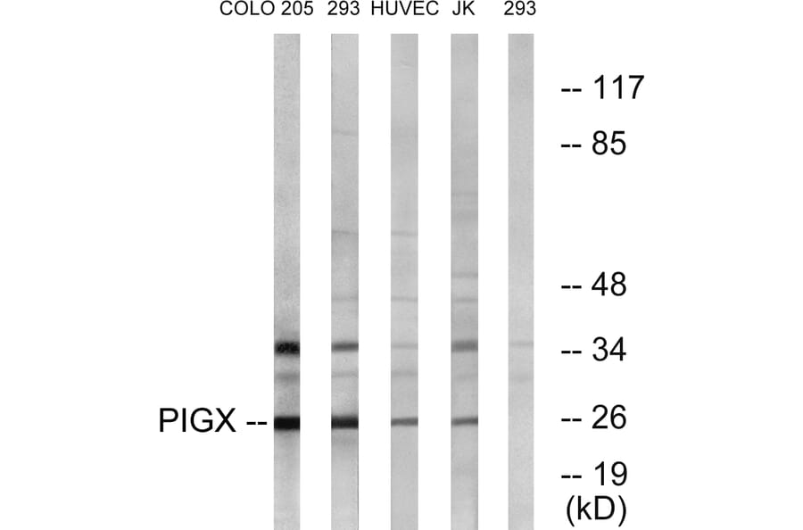 Western Blot - Anti-PIGX Antibody (C17700) - Antibodies.com