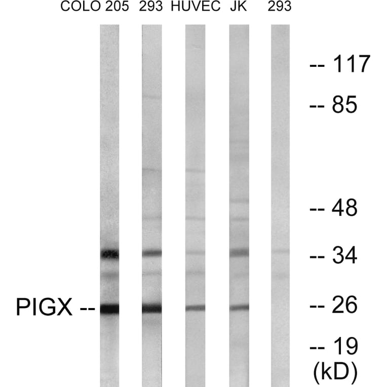 Western Blot - Anti-PIGX Antibody (C17700) - Antibodies.com