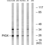 Western Blot - Anti-PIGX Antibody (C17700) - Antibodies.com