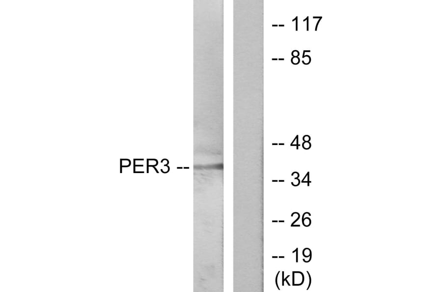 Western Blot - Anti-PER3 Antibody (C10752) - Antibodies.com