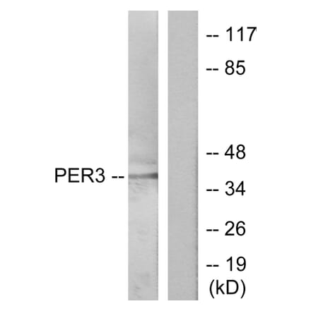 Western Blot - Anti-PER3 Antibody (C10752) - Antibodies.com