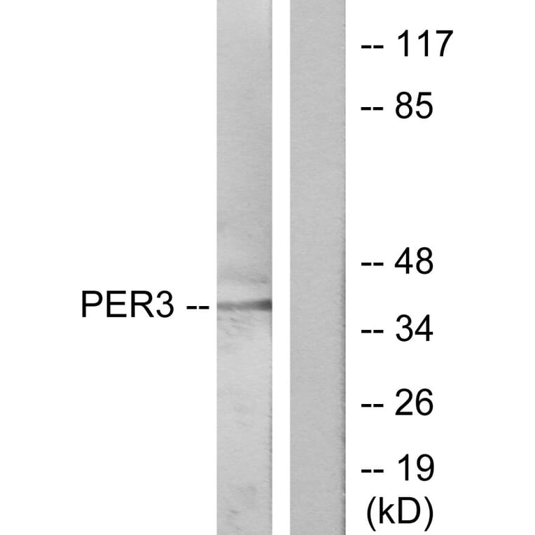 Western Blot - Anti-PER3 Antibody (C10752) - Antibodies.com