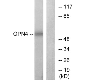 Western Blot - Anti-OPN4 Antibody (G488) - Antibodies.com