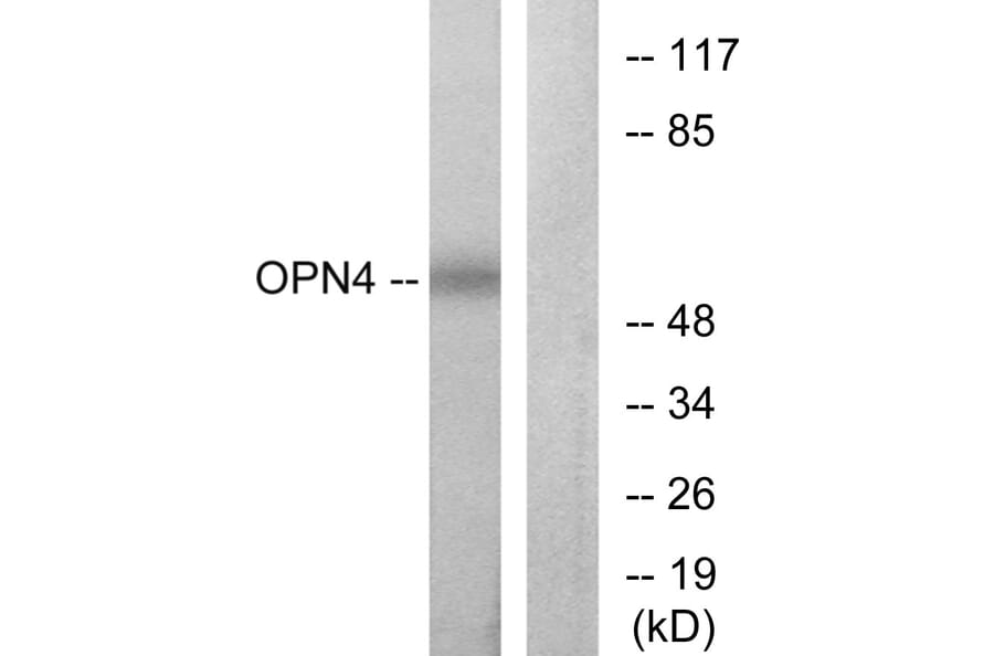 Western Blot - Anti-OPN4 Antibody (G488) - Antibodies.com