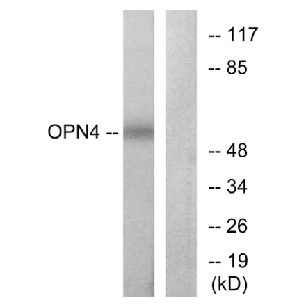 Western Blot - Anti-OPN4 Antibody (G488) - Antibodies.com