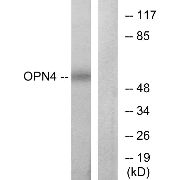 Western Blot - Anti-OPN4 Antibody (G488) - Antibodies.com